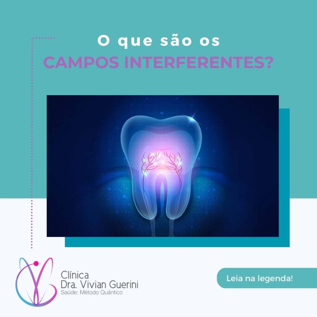O que são Campos Interferentes?