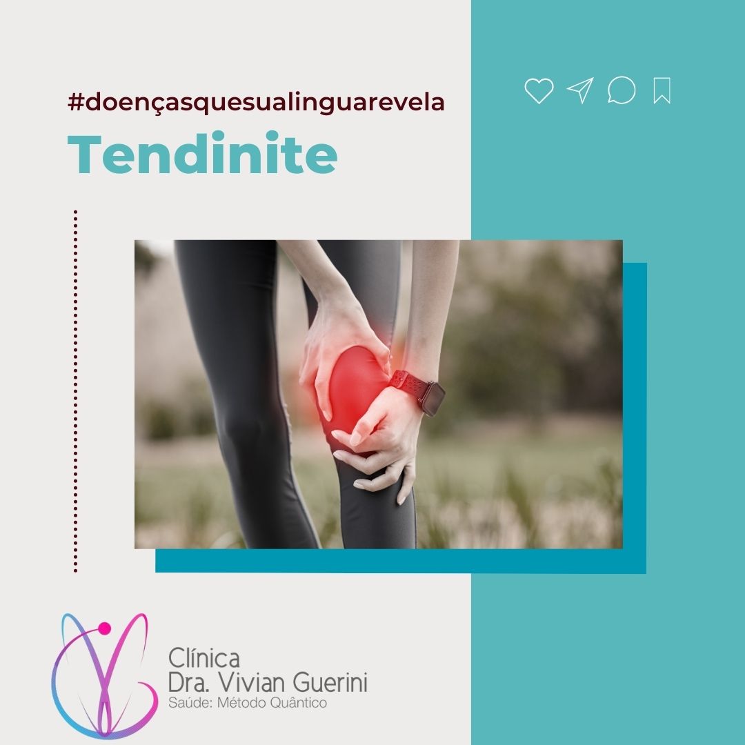 Tendinite
