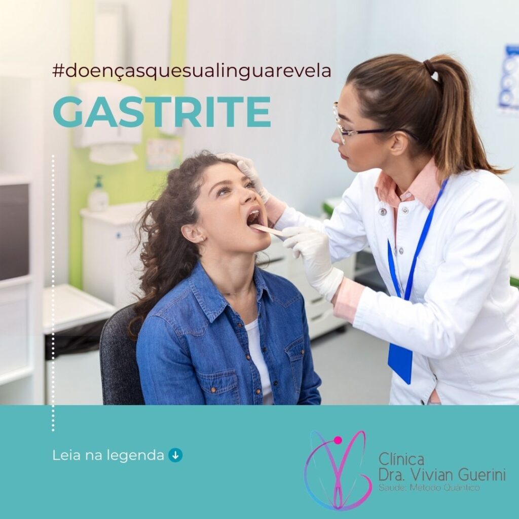 Gastrite