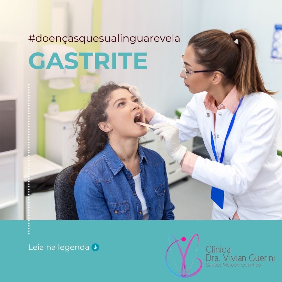 Gastrite