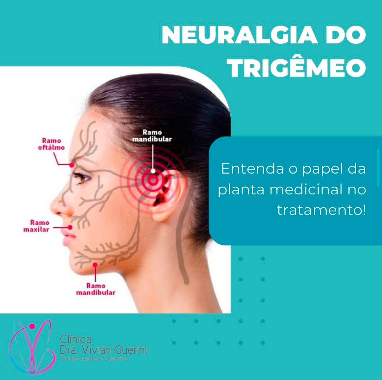 Neuralgia do trigêmeo